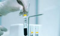 Blood test trends may help identify increased risk of cancer