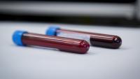 CHMP backs Novo's haemophilia A drug Frehemgo