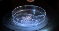 Dengue fever: 3 cases in Orange County; 152 local cases in Florida