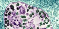 A Scientist Bled to Death for Two Weeks. The Virus He Left Behind Is Sitting in His Lab.