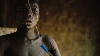 South African govt raises alarm over rising mpox cases, calls for public vigilance