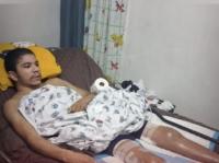 Family seeks help for 30-year-old Dominican man with rare disease