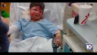 7-year-old boy burned in fire after science experiment with household items goes wrong