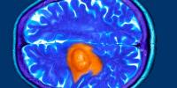 Scientists make significant brain breakthrough — and it could change how humans treat diseases