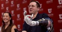 This bionic arm sounds like science fiction — but it’s not