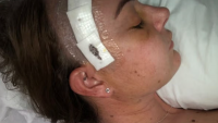 Doctors told to warn women of depo jab brain tumour risk after dozens of victims speak out