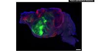Researchers use mice with human brain cells to study Alzheimer's