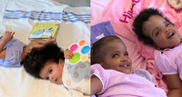 Ethiopian conjoined twins separated after 25-hour surgery in US