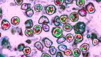 Health officials warn of recent measles exposure at PHL Airport