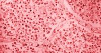 NYC Health expands Legionnaires' disease outreach area in South Bronx as testing continues