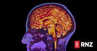 Alzheimer's disease starting to be considered a treatable condition - study