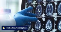 Japanese surgeon removes healthy brain tissue, leaving woman on ventilator