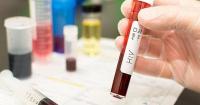 More access to HIV drugs