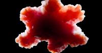 Organoids reveal unprecedented features in the tumor margins of multicentric breast cancer