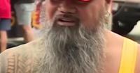 Kansas City Chiefs Fan Debuts Team-Themed Prosthetic Eye