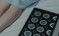 Global multiple sclerosis cases reach 3.1 million