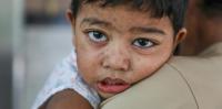 Bangladesh has lost 900 children to measles – a warning to other countries where vaccine rates have slipped