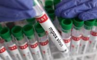 Health Department confirms rise in mpox cases to 26