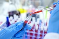 EU HIV diagnoses plateau as campaigners demand new action plan