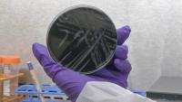 7 South Bronx cooling towers test positive for live Legionella bacteria