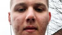 Bolton man, 25, who weighed 150kg and didn't leave home for months over severe acne is now Mr England finalist in incredible transformation