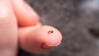 Los Angeles Has a Flea Problem—and It’s Fueling Typhus Outbreaks
