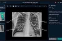 Ateneo researchers ask: Can AI help bridge the public health gap?