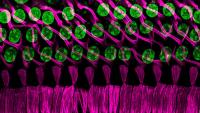 Israeli scientists help solve genetic mystery linking hearing loss and gray hair