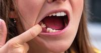 Lost a tooth? Science may one day grow it back
