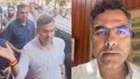 Delhi minister Parvesh Verma slaps man filming him while inspecting broken road in west Delhi