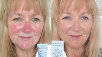 Mature beauty buffs 'feel younger' after trying 'confidence-boosting' £25 cream