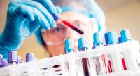 The Chemistry of Certainty: What Medical Tests Really Measure