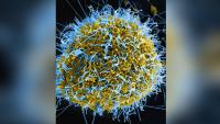 Congo Ebola cases cross 8,000 due to uncontrolled outbreak