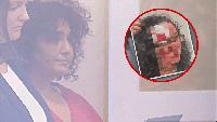 Seattle woman accused of biting off victim's forehead to undergo mental health evaluation