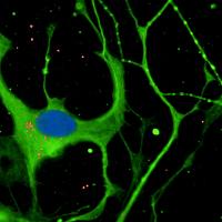 CE-Ventures Backs Aptadir Therapeutics in €40 Million Seed Round, One of Europe’s Largest in Biotech