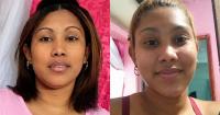 Cuba: the tragedy of Aniari Barrientos and the collapse of the healthcare system