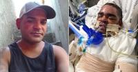Cuban deported to Cuba after an absent order seeks to reopen his case: He was in a coma for months