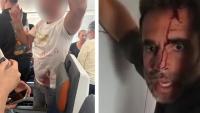 FlyDubai hijacking: Pilot arrested after captain stabbed in apparent bid to hijack Israel-bound passenger jet