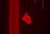 Japanese hospital performs world-first surgery using heart muscle stem cells