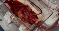 Heart in a box. Canadian-first technology opens new possibilities for lifesaving transplants.
