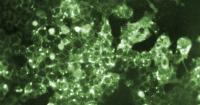 Pennsylvania reports 5th measles-related death in the state