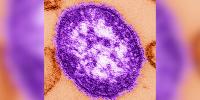 Pennsylvania records 5th measles death amid worst US year since 1991