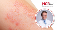 Nemolizumab Sustains AD Response at 3 Years, With Matthias Augustin, MD