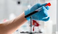 New study finds ‘forever chemicals’ in blood of all 10 Croatian participants