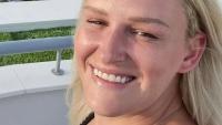 My nose was removed and reconstructed with my RIB in horror op after bizarre nosebleed when I jumped off boat in Turkey