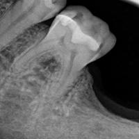 Shane Parish Surprise Releases New Album Dental Work To Pay For His Dental Work