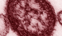 Measles milestones: US closes in on 4,000 cases as Pennsylvania nears 1,000