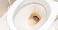 Remove unsightly brown toilet stains without any strong chemicals