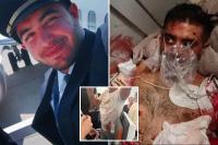 Flydubai co-pilot used crash ax to hack at pilot in attempted ‘terrorist attack’: UAE official