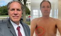 What happens in Vegas: Man says friend's nipple twisting on vacation led to breast cancer discovery